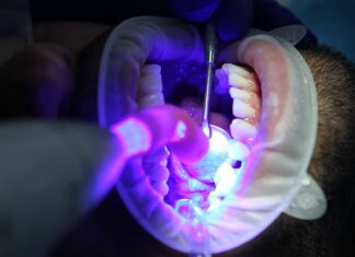 Czy do wybielania zębów trzeba mieć zdrowe zęby?