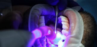 Czy wybielanie zębów w gabinecie boli?