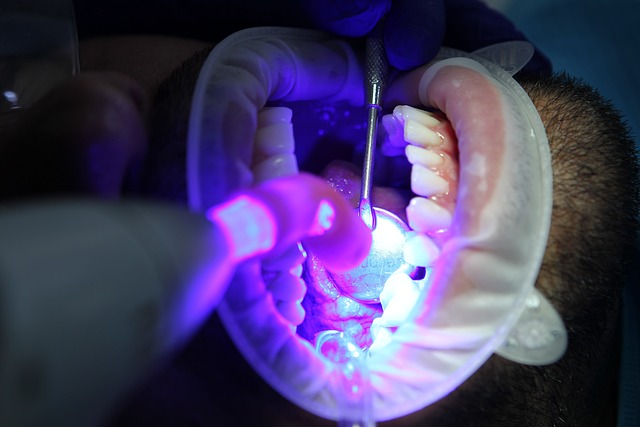 Czy wybielanie zębów w gabinecie boli?